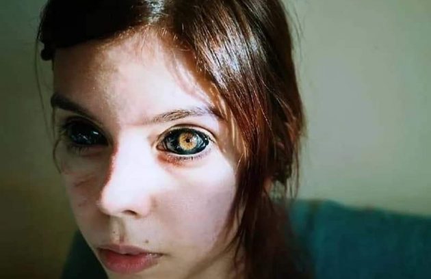 وشم داخل العين حيث وشمت فتاة بولندية عينها باللون الأسود