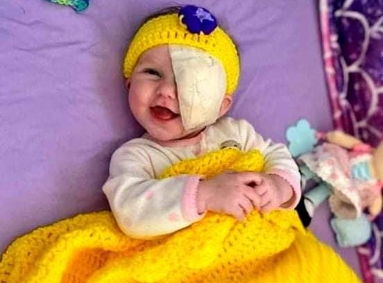 محاربة صغيرة .. صورة ل محاربة صغير بعد استئصال ورم سرطاني من العين