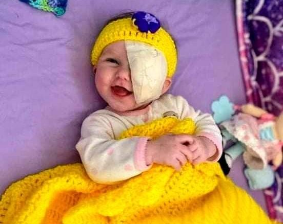 محاربة صغيرة .. صورة ل محاربة صغير بعد استئصال ورم سرطاني من العين